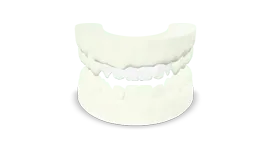 Ceratura Diagnostica (Wax-Up)