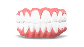 Ponte in Zirconia Avvitato